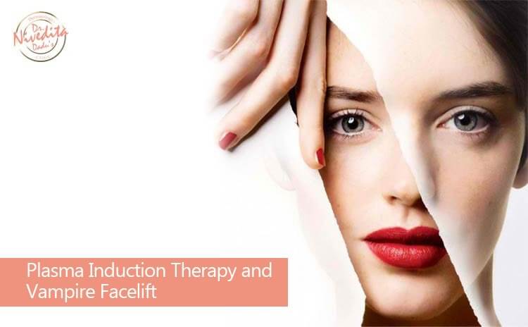 Advanced HGP or vampire face lift