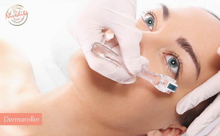 dermaroller-treatment