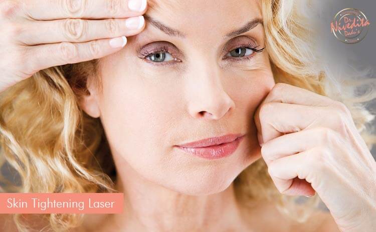 skin-tightening-laser