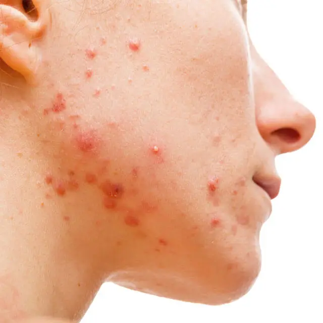 Top 10, Best Dermatologist Doctor for Skin in Delhi, West Delhi, Rajouri Garden