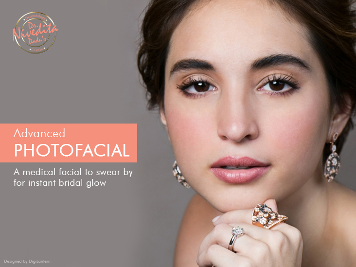 Advanced Photofacial - A medical facial