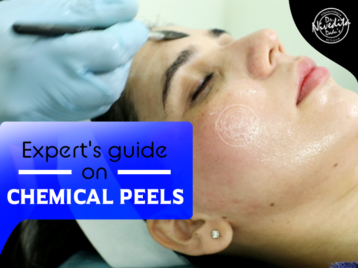 Expert Guide for Chemical Peels!
