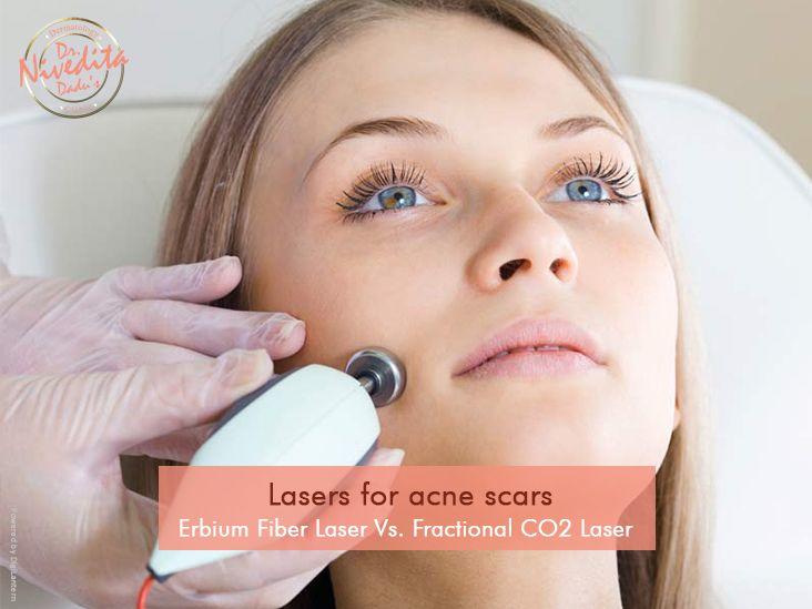 Fractional CO2 Laser