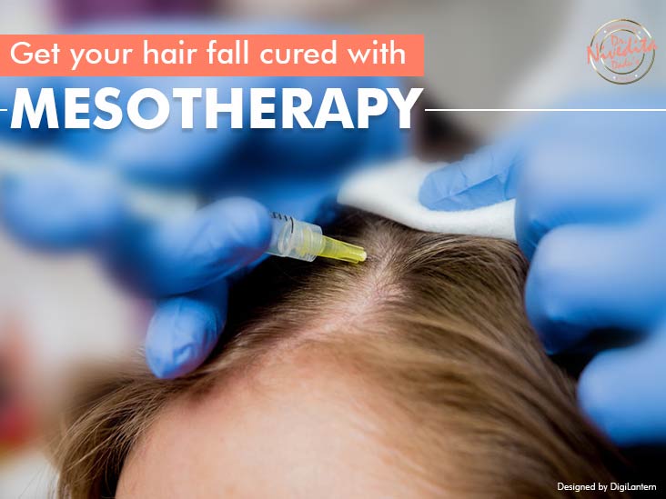 Mesotherapy Hair Loss Treatment