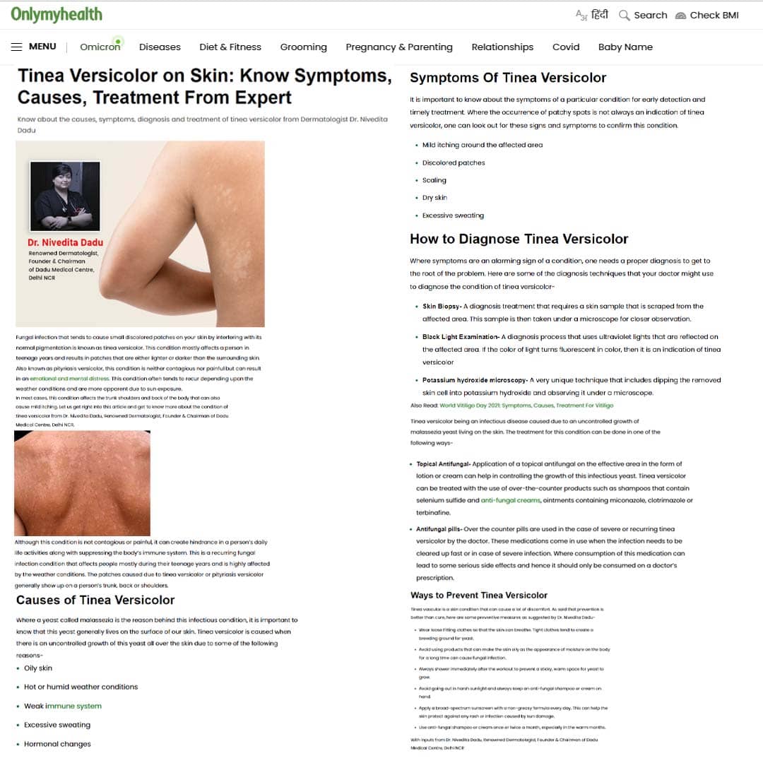 Tinea Versicolor on Skin: Know Symptoms, Causes, Treatment From Expert