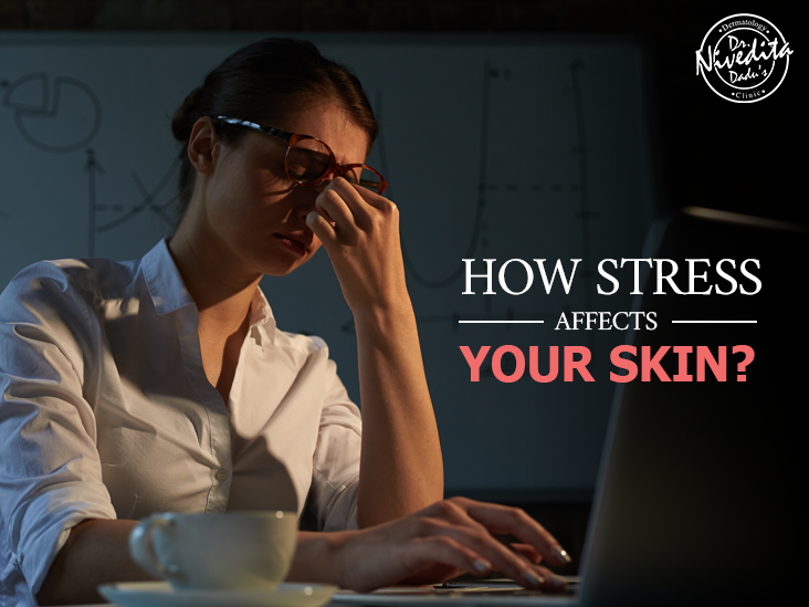 stress and skin