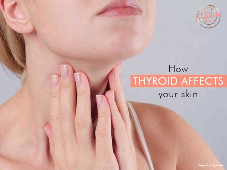 Thyroid affects your skin