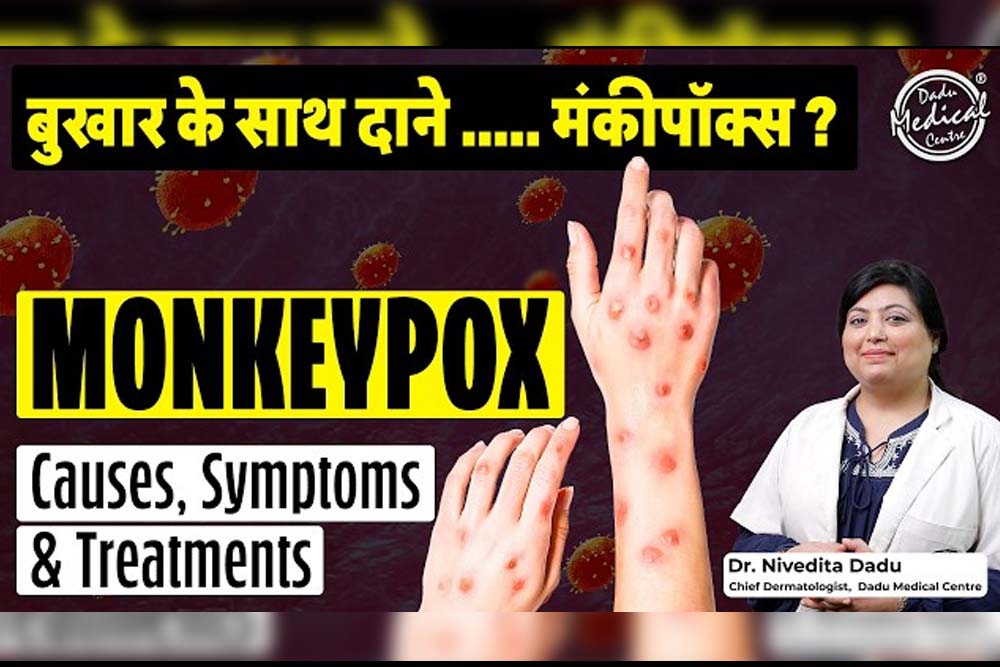 blog-thumb