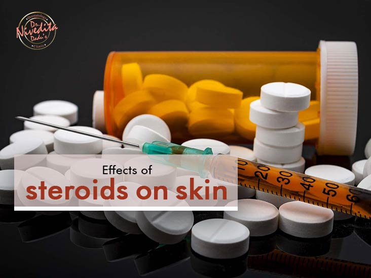 Effect Of Steroids on Skin