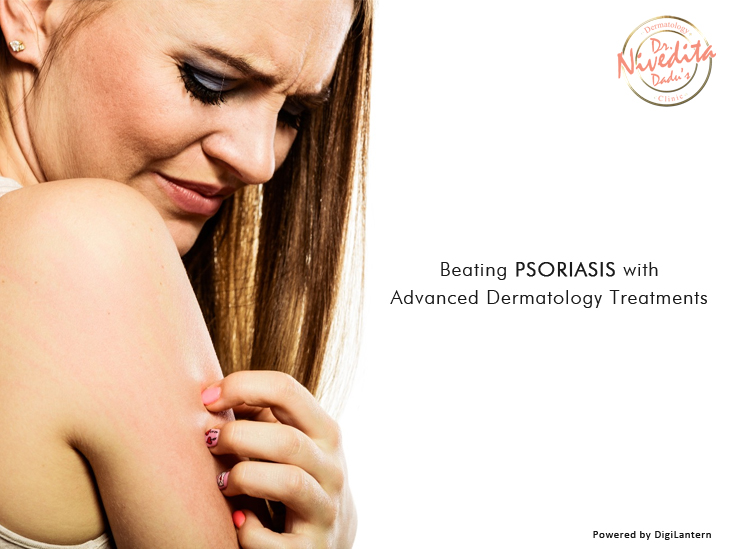 Psoriasis with Advanced Dermatology Treatments