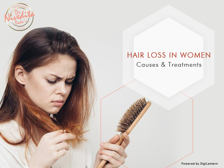 Hair fall and loss in Women