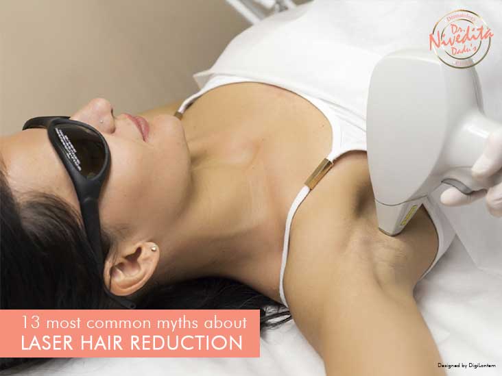 13 most common myths about Laser Hair Reduction