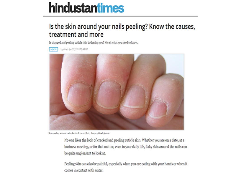 Peeling Skin on Fingers: 9 Home Remedies and Treatment