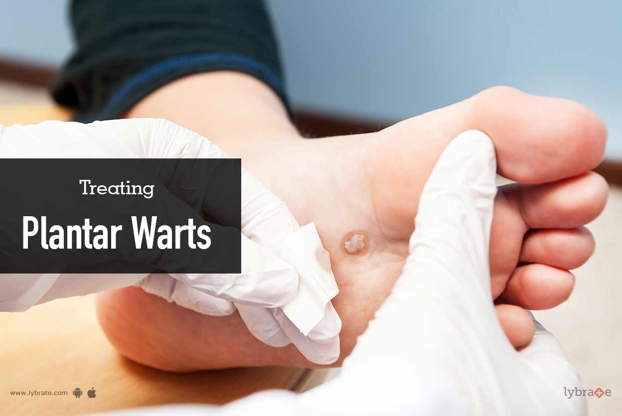 Plantar Warts Duct Tape